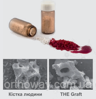 Материал для ремоделирования кости THE Graft&trade; Purgo 0.5 г (1.2 куб. см)